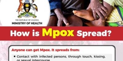 Mpox-health-2.jpg