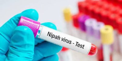 Nipah-Virus-Test-1.jpg